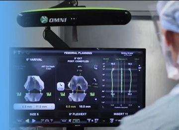 Robotsebészet az ortopédiában: hogyan alakítja át a mozgásszervi műtéteket a jövő technológiája?